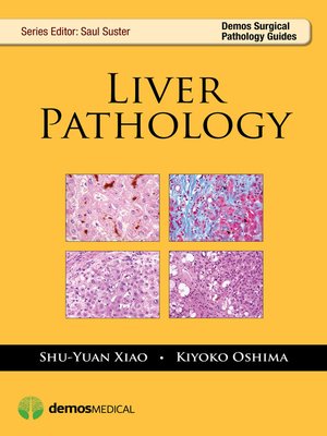 cover image of Liver Pathology